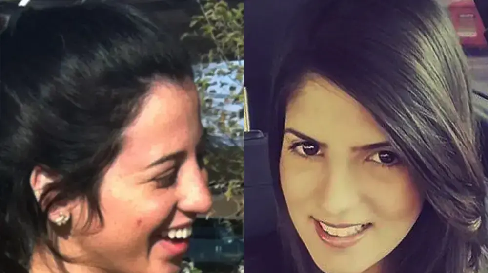 מיתר לוגסי נירית וטובסקי מפוצלת מיתר לוגסי נירית וטובסקי מפוצלת