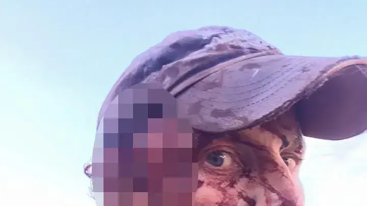 מטייל שהותקף על ידי דובה, אוקטובר 2016