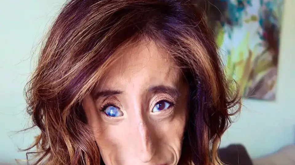 ליז וואלסקז ליז וואלסקז