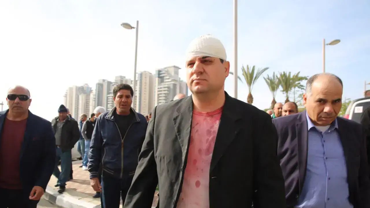 איימן עודה נפצע במהלך עימותים בכפר אום אל-חיראן בנגב. 18 בינואר 2017 איימן עודה נפצע במהלך עימותים בכפר אום אל-חיראן בנגב. 18 בינואר 2017