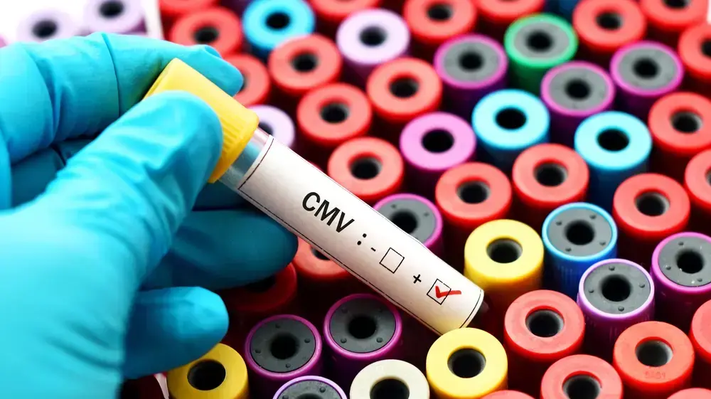 נגיף CMV נגיף CMV
