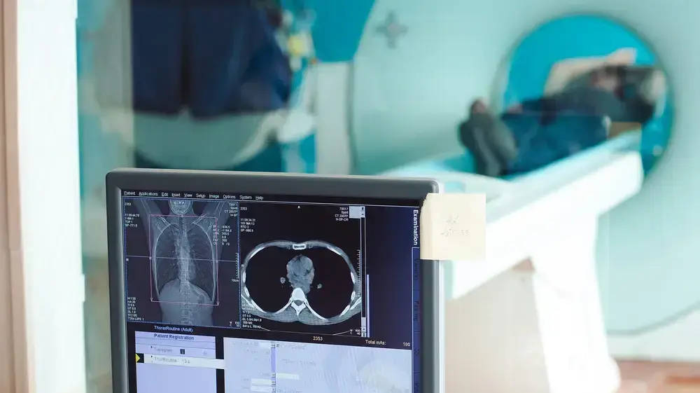 בדיקת MRI