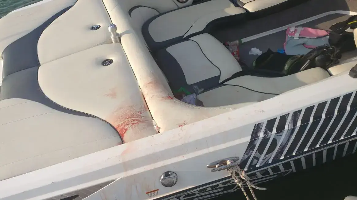 גבר נפצע אנוש ממנוע של סירה בכנרת, אפריל 2017
