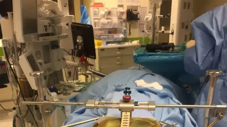 אהרון שוורץ שנפל על קיר ברל לאחר הניתוח שנועד לקבע את חוליות הגב שלו, 20 באפריל 2017 אהרון שוורץ שנפל על קיר ברל לאחר הניתוח שנועד לקבע את חוליות הגב שלו, 20 באפריל 2017