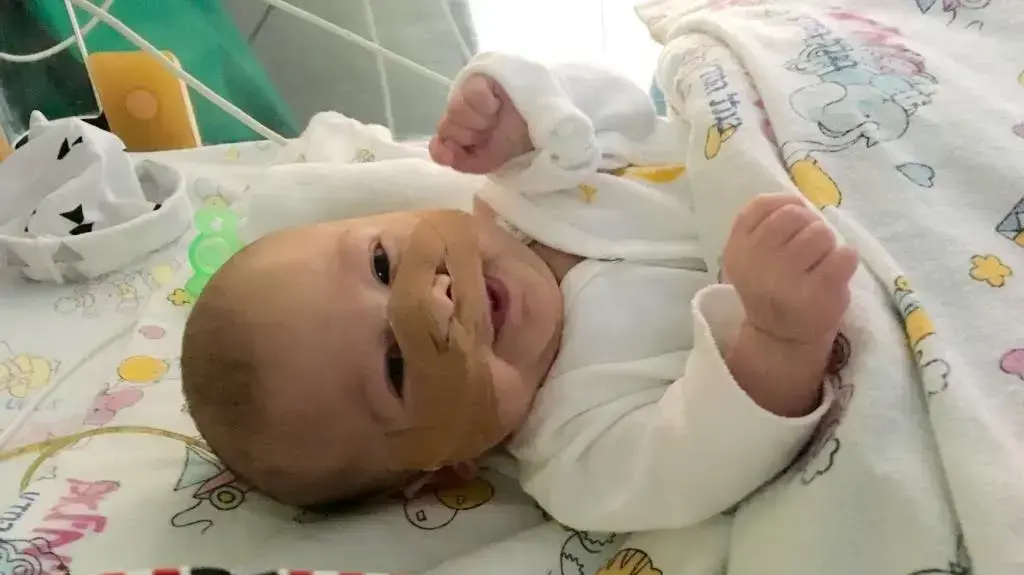 ליאם יצחק טמיר, תינוק שנולד עם מום חמור בקנה הנשימה