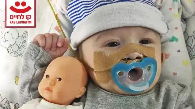 ליאם יצחק טמיר, תינוק שנולד עם מום חמור בקנה הנשימה ליאם יצחק טמיר, תינוק שנולד עם מום חמור בקנה הנשימה