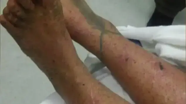 ליסה טריס נמצאה פצועה ומלאת עקיצות ליסה טריס נמצאה פצועה ומלאת עקיצות