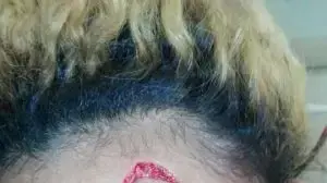 דוגמנית מדרום אפריקה שטוענת כי הוכתה בידי הגברת הראשונה של זימבבואה גרייס מוגאבה, אוגוסט 2017