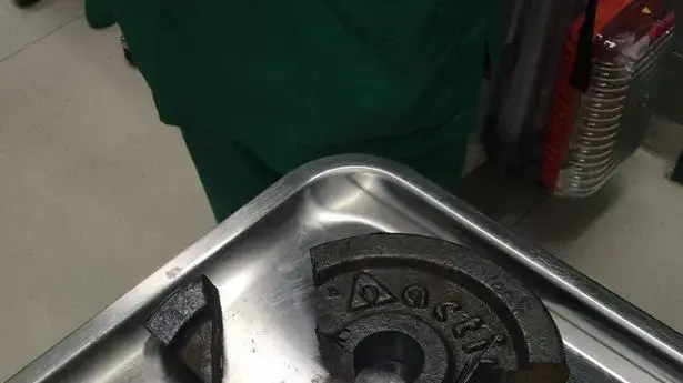 גבר נתקע עם איבר מינו במשקולת צלחת גבר נתקע עם איבר מינו במשקולת צלחת