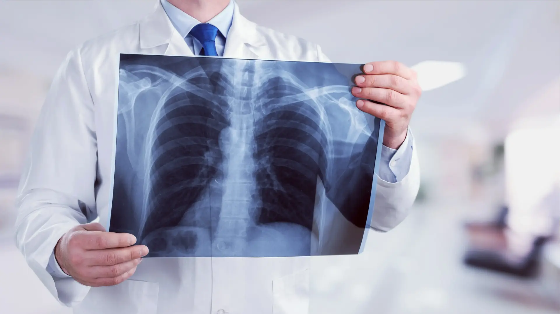 שאלות שכיחות בקרב חולי ריאות ואלרגיה ליום כיפור 