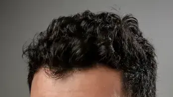 יניב ביטון יניב ביטון
