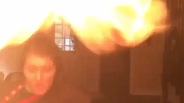 ילדה ניסתה להכין צ'יפס ולרקוד וכמעט הציתה את עצמה ואת חברתה ילדה ניסתה להכין צ'יפס ולרקוד וכמעט הציתה את עצמה ואת חברתה