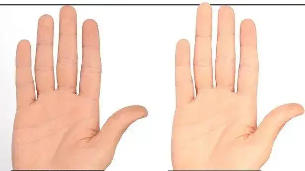 מחקר אצבעות מחקר אצבעות