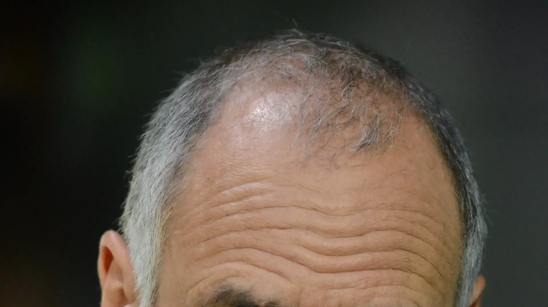 דויד ברוזה דויד ברוזה