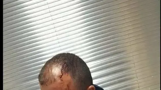 נהג אגד שהותקף בנסיעה לקרית ארבע, 18 בפברואר 2018 נהג אגד שהותקף בנסיעה לקרית ארבע, 18 בפברואר 2018
