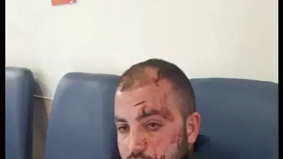 נהג אגד שהותקף בנסיעה לקרית ארבע, 18 בפברואר 2018 נהג אגד שהותקף בנסיעה לקרית ארבע, 18 בפברואר 2018