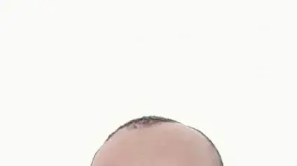 מוחמד איברהים חליל אבו טין ההרוג מפיצוץ בלון הגז בירושלים מוחמד איברהים חליל אבו טין ההרוג מפיצוץ בלון הגז בירושלים
