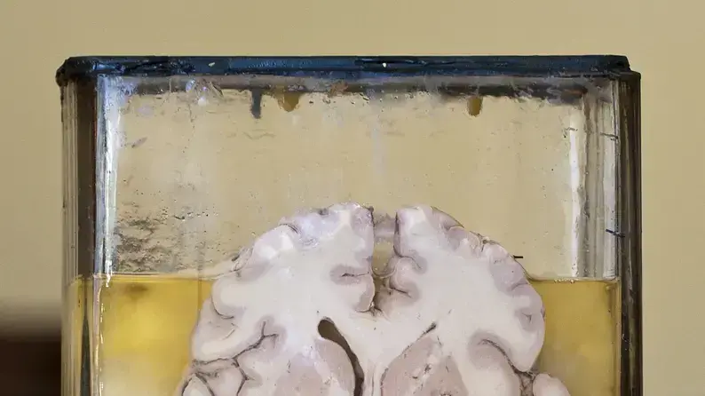 פיסת מוח משומרת בתוך צנצנת פורמלין פיסת מוח משומרת בתוך צנצנת פורמלין