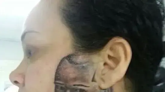 הקעקועים הגרועים ביותר בעולם