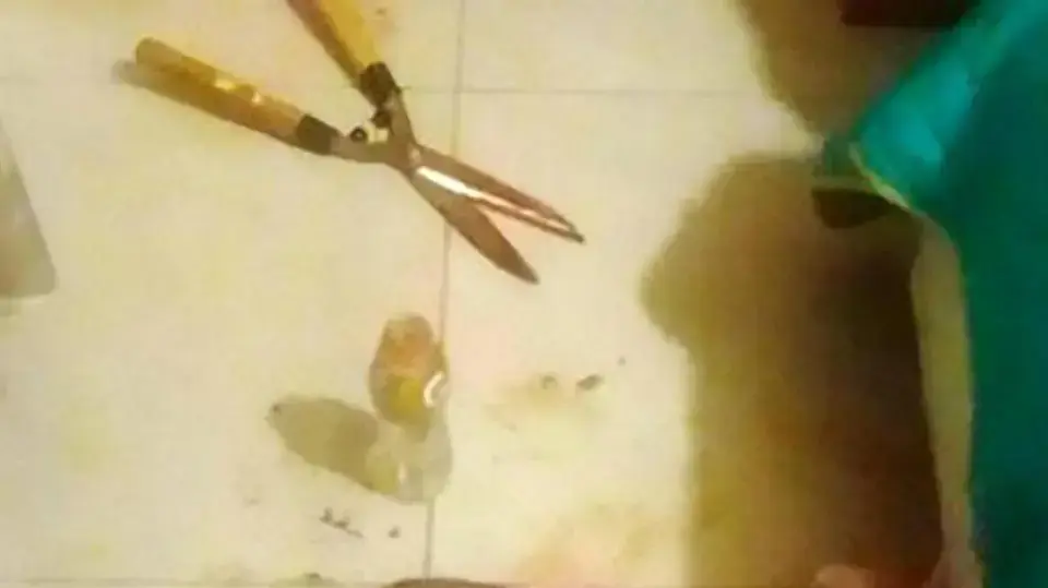 קטעה לבן זוגה את איבר המין קטעה לבן זוגה את איבר המין