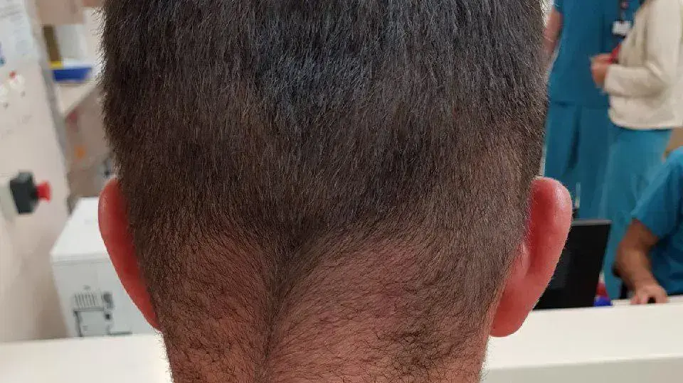 מאבטחים נחבלו במהלך קטטה רבת משתתפים בבית חולים רמב"ם בחיפה מאבטחים נחבלו במהלך קטטה רבת משתתפים בבית חולים רמב"ם בחיפה