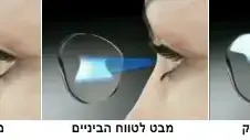 עשות מולטיפוקל
