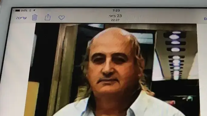 אמנון לוי לפני הניתוח אמנון לוי לפני הניתוח