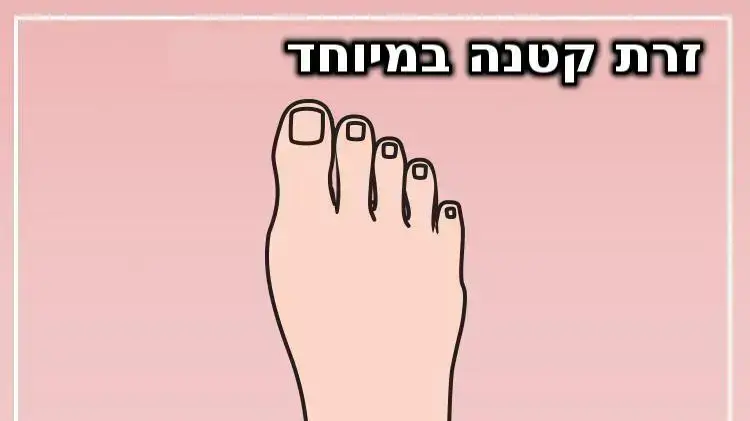סוגי כפות רגליים - זרת קטנה במיוחד סוגי כפות רגליים - זרת קטנה במיוחד