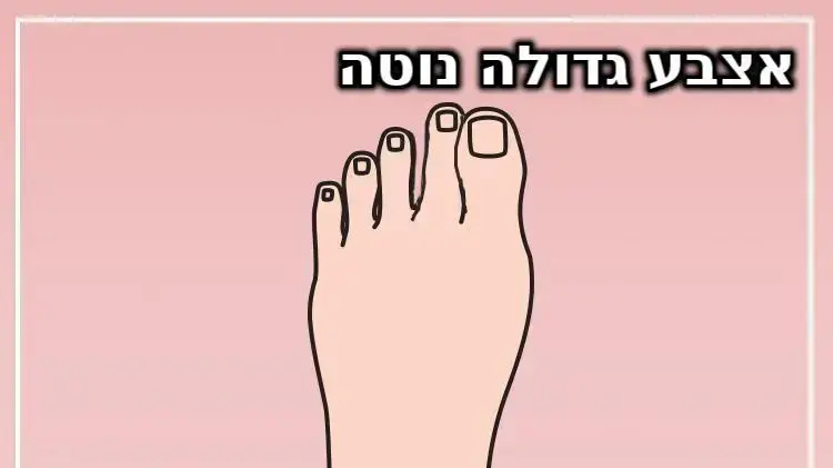 סוגי כפות רגליים - אצבע גדולה נוטה סוגי כפות רגליים - אצבע גדולה נוטה