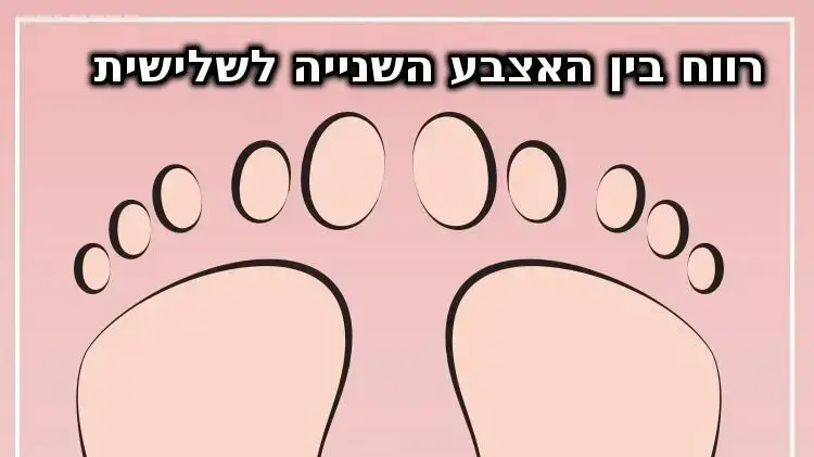 סוגי כפות רגליים - רווח בין האצבע השנייה לשלישית סוגי כפות רגליים - רווח בין האצבע השנייה לשלישית