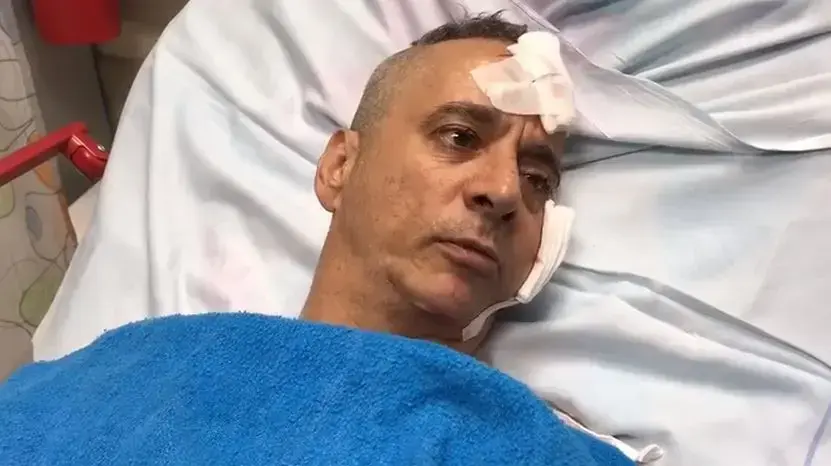 תושב שדרות שנפצע מנפילת רקטה בביתו, 14 ביולי 2017 תושב שדרות שנפצע מנפילת רקטה בביתו, 14 ביולי 2017