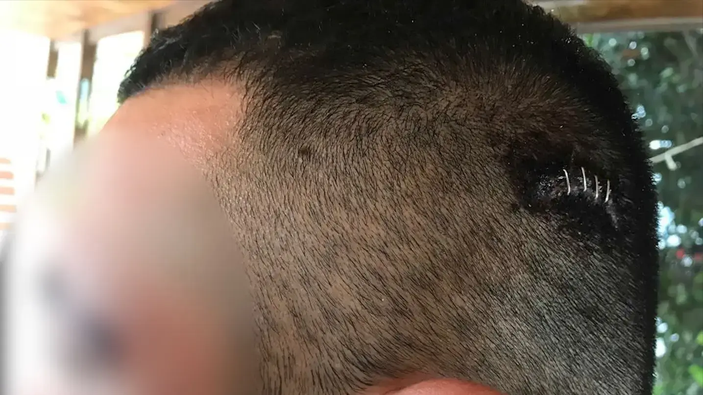 הבחור הערבי אשר הותקף בקריות הבחור הערבי אשר הותקף בקריות