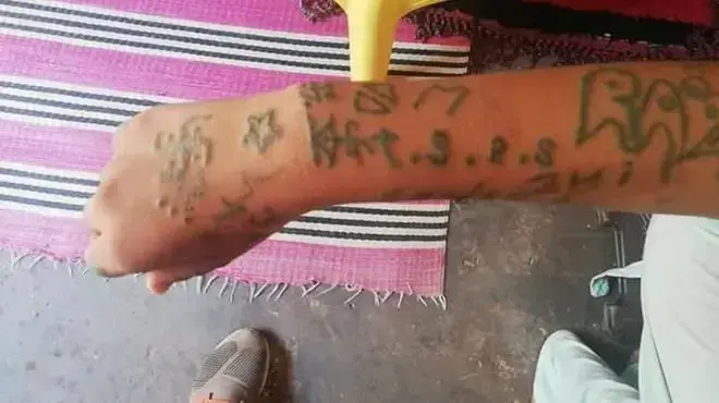 ידה של נערה במרוקו, שסיפרה כי עונתה ונאנסה במשך חודשיים על ידי קבוצת גברים, אוגוסט 2018
