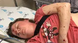 המטופלת שהוכתה בלילי חמישי בכניסה למיון בבית החולים וולפסון בחולון המטופלת שהוכתה בלילי חמישי בכניסה למיון בבית החולים וולפסון בחולון