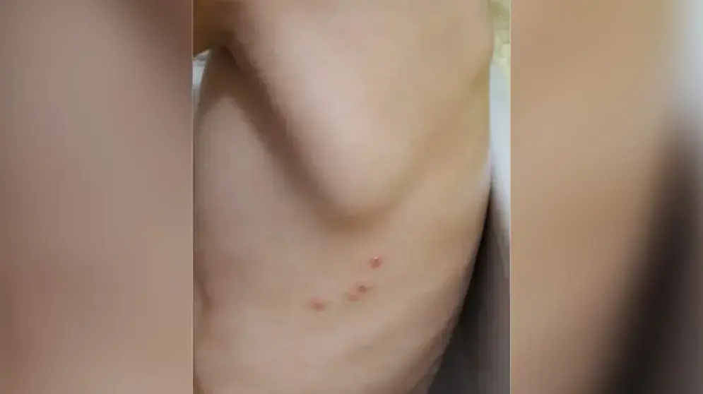 ילד שנעקץ בגן בנהריה ילד שנעקץ בגן בנהריה