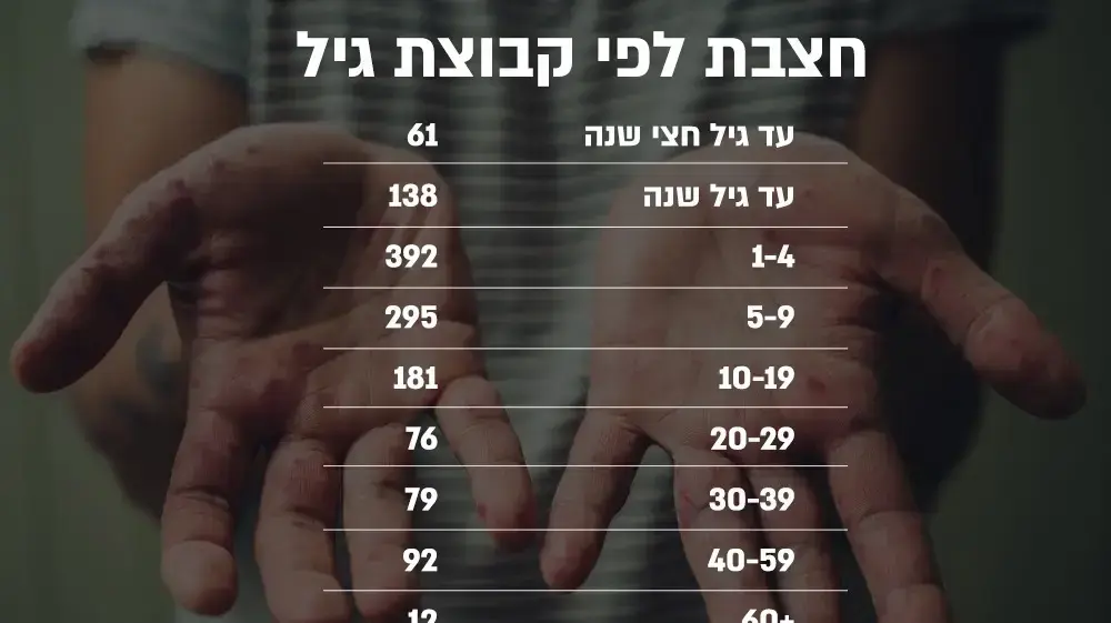 אינפו - חצבת אינפו - חצבת