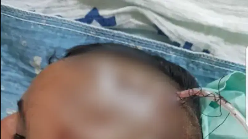 אלימות בבית ספר בדרום (הילד שניזוק מהאירוע ופונה לבית החולים) אלימות בבית ספר בדרום (הילד שניזוק מהאירוע ופונה לבית החולים)