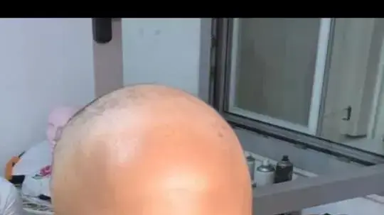 תהל תמסיט, ראש לשכתו של ראש העיר היוצא בקריית שמונה, עברה השתלת מח עצם לפני שבועות אחדים - אך זומנה לשימוע תהל תמסיט, ראש לשכתו של ראש העיר היוצא בקריית שמונה, עברה השתלת מח עצם לפני שבועות אחדים - אך זומנה לשימוע