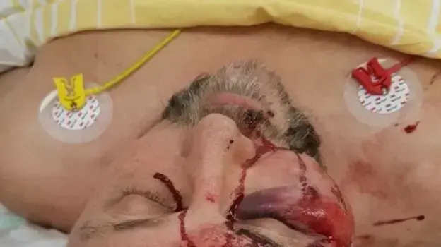 פרנק מגניץ, חבר פרלמנט מהימין הקיצוני של גרמניה, מאושפז בבית חולים, ינואר 2019