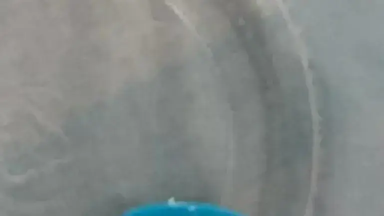 לחדר מיון ילדים במרכז הרפואי קפלן הגיעה בת שנתיים וחצי לאחר בליעת מגנט משחק בצורת לב. לחדר מיון ילדים במרכז הרפואי קפלן הגיעה בת שנתיים וחצי לאחר בליעת מגנט משחק בצורת לב.