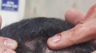 חבלות השוטר שהותקף לטענתו על ייד צעיר ערבי בדיר אל אסד חבלות השוטר שהותקף לטענתו על ייד צעיר ערבי בדיר אל אסד