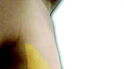 מבשנה השד הנשי בעת הנקה מבשנה השד הנשי בעת הנקה