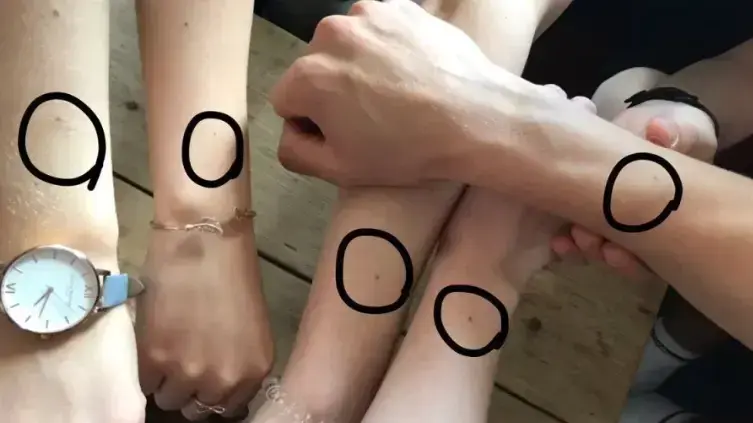 נשים עם נמש על גב היד נשים עם נמש על גב היד
