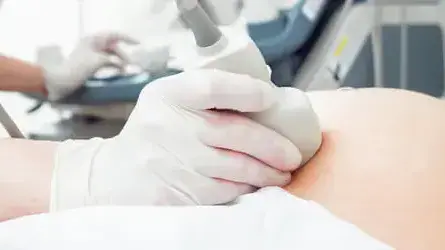 הריון הריון
