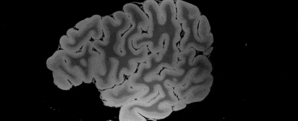 גיף הדמיית מוח MRI גיף הדמיית מוח MRI