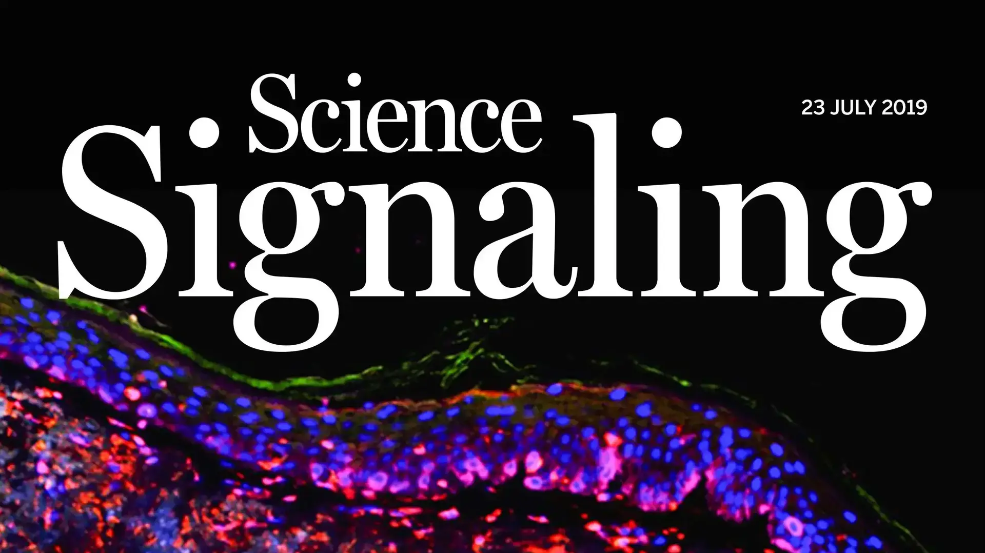 תמונת השער של כתב העת Science Signaling - חתך עור של דגימת מלנומה הצבוע בצבעים פלורסנטיים המשמשים כסמנים תמונת השער של כתב העת Science Signaling - חתך עור של דגימת מלנומה הצבוע בצבעים פלורסנטיים המשמשים כסמנים