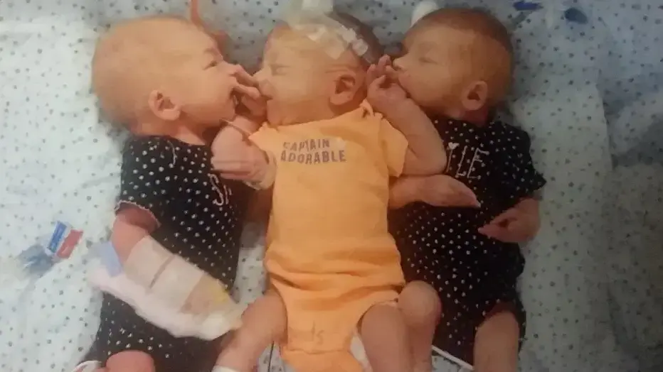 שלישיה בהפתעה: אישה מדקוטה חשבה שיש לה אבנים בכליות
וגילתה שהיא בהיריון עם שלושה תינוקות