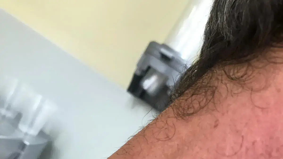 ניק פנקס ממושב ברמת הגולן שטוען כי הרביצו לו לאחר שהעיר למתארחים בצימר לא לקטוף מהמטע שלו, ספטמבר 2019 ניק פנקס ממושב ברמת הגולן שטוען כי הרביצו לו לאחר שהעיר למתארחים בצימר לא לקטוף מהמטע שלו, ספטמבר 2019