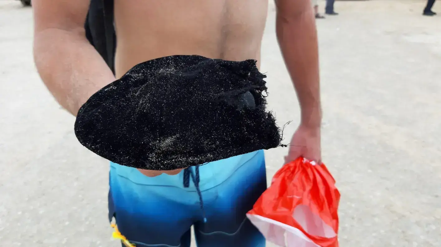כיפת אחד הנערים שנפצעו מפגיעת הברק בחוץ זיקים. ה-15 לאוקטובר 2019