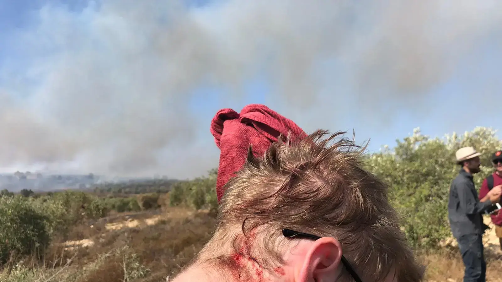 פעיל ארגון "רבנים לזכויות אדם" שהותקף בבורין, 16 באוקטובר 2019 פעיל ארגון "רבנים לזכויות אדם" שהותקף בבורין, 16 באוקטובר 2019